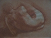 voros